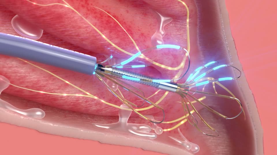Medical Device Animation