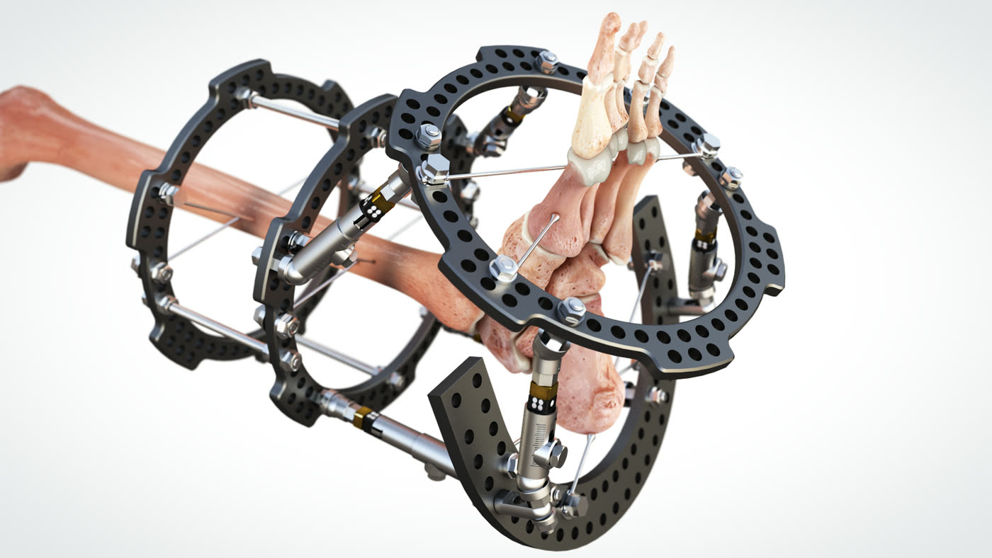 Dynamic strut mechanism